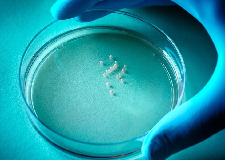 Brain organoids in a Petri dish